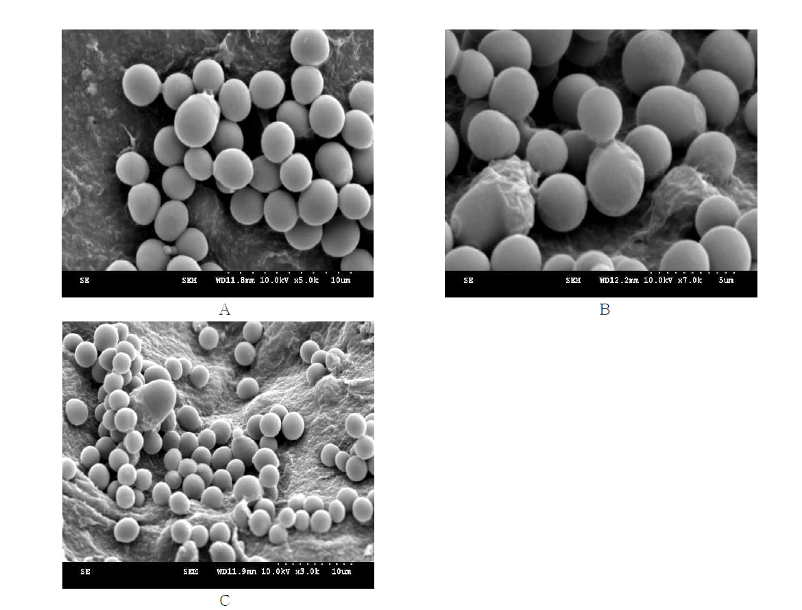 Scanning electron microscopy image of Candida albicans