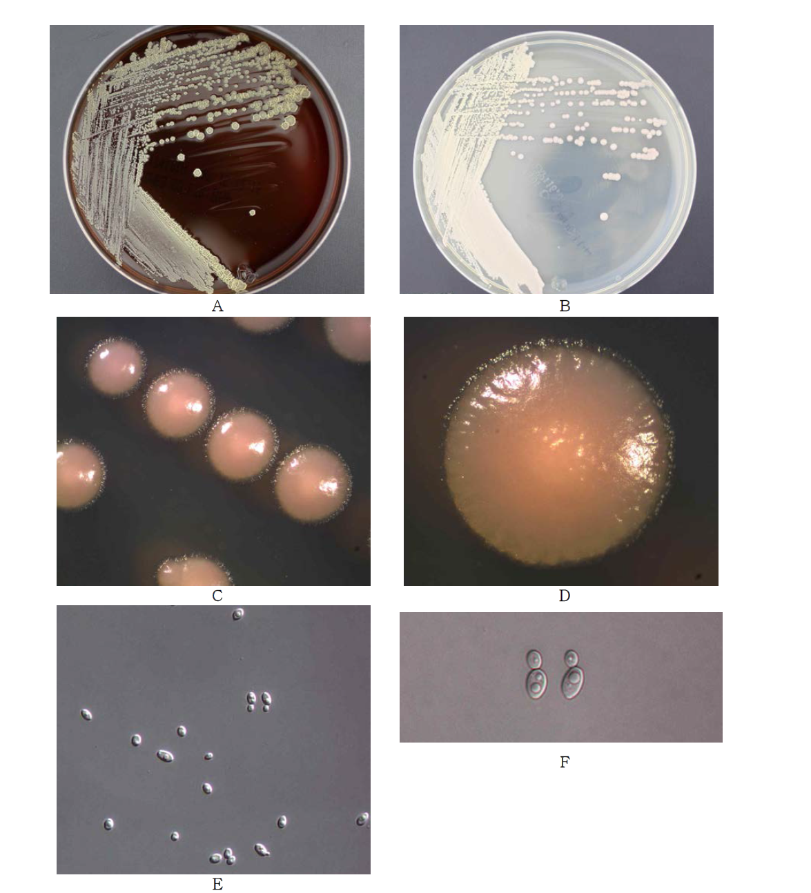 Morphological analysis of Candida parapsilosis