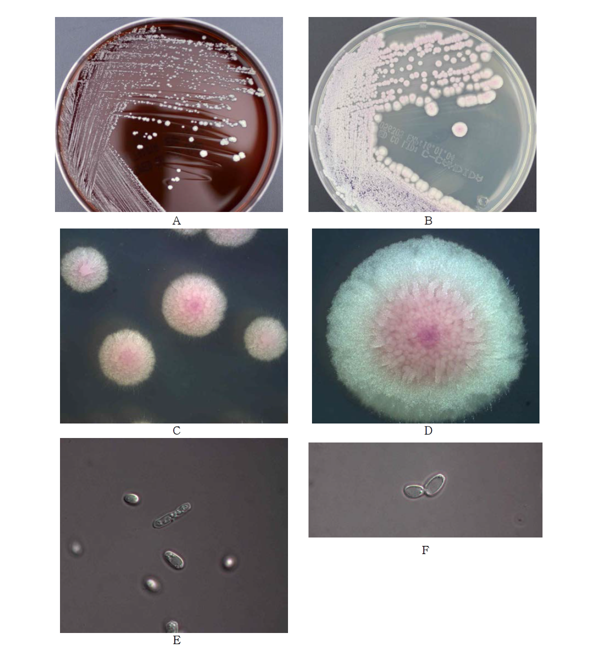 Morphological analysis of Candida krusei