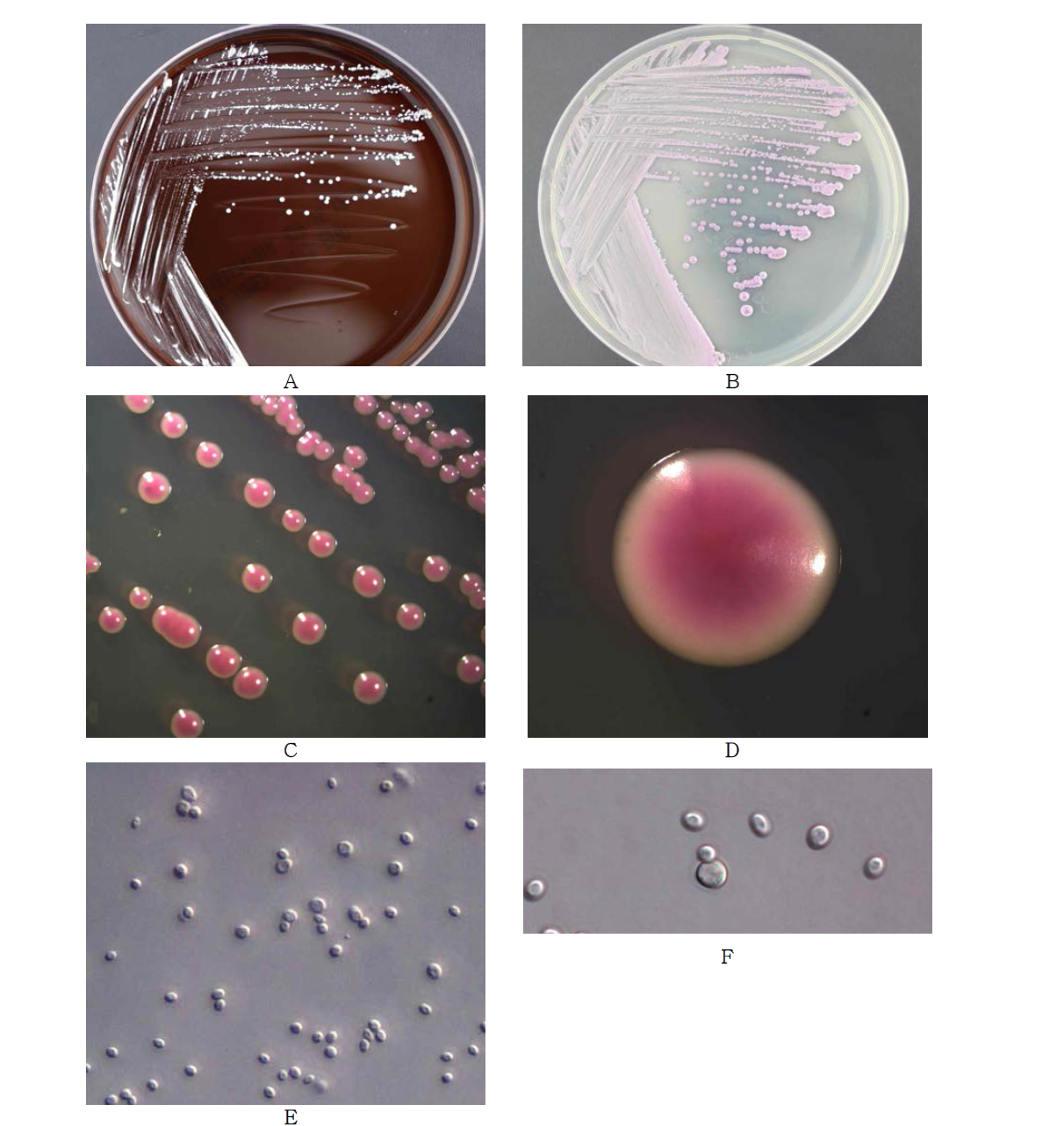 Morphological analysis of Candida glabrata