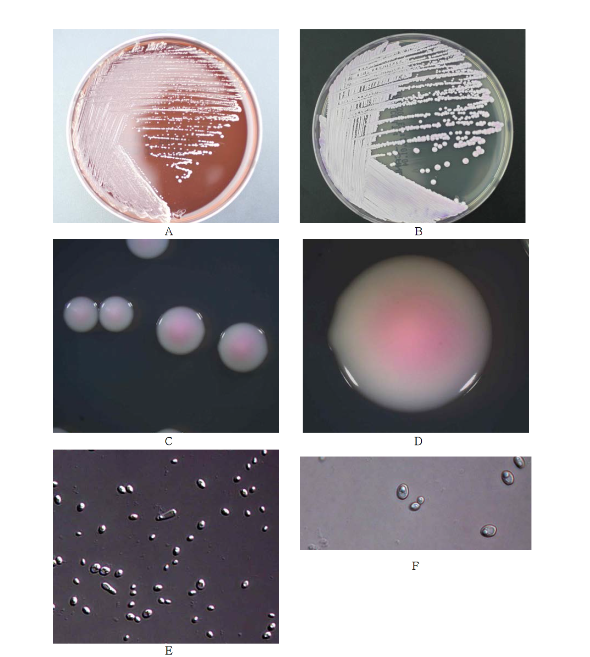 Morphological analysis of Candida guilliermondii