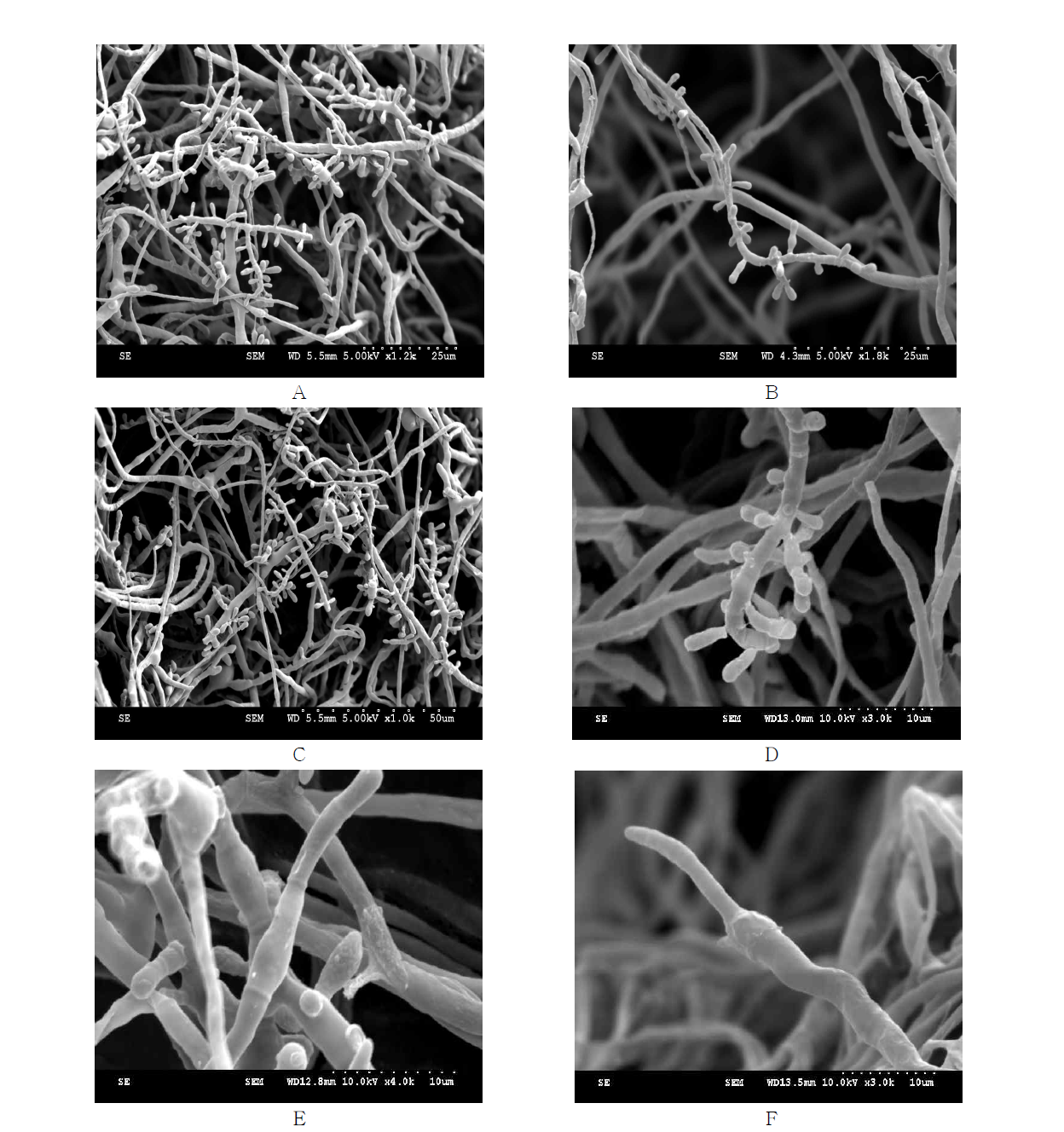 Scanning electron microscope image of Trichophyton rubrum.