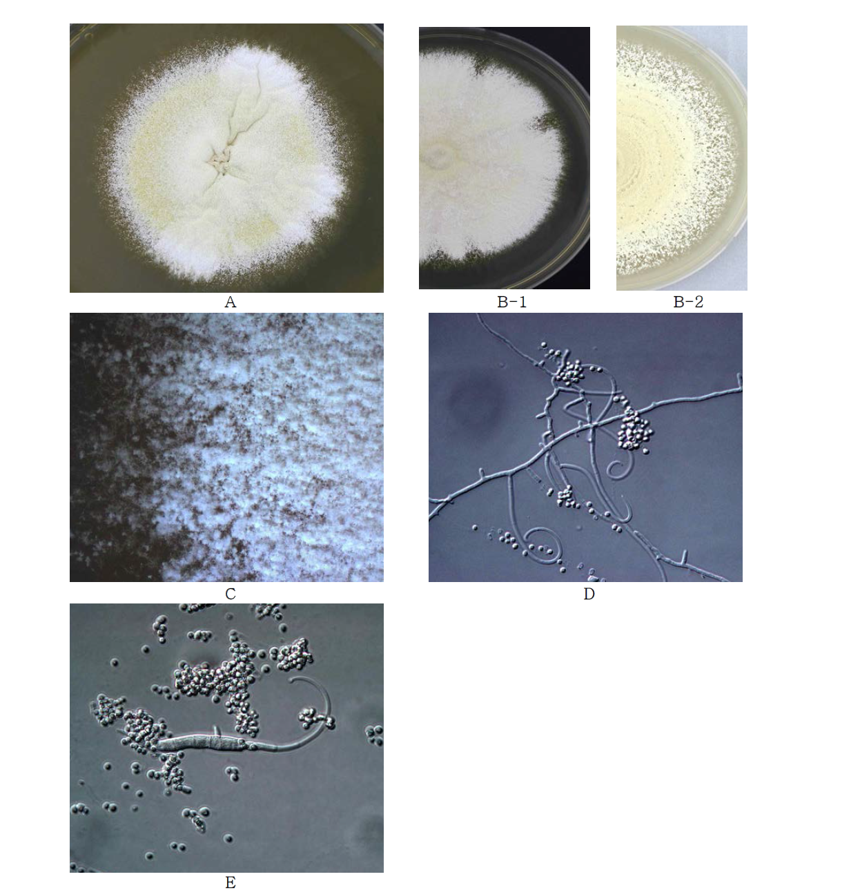 Morphological analysis of Trichophyton mentagrophytes