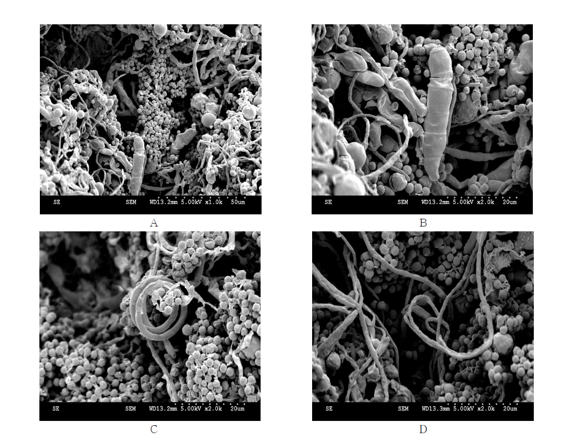 Scanning electron microscope image of Trichophyton mentagrophytes.