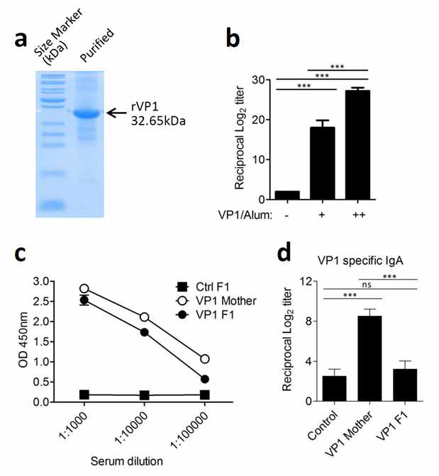 엔테로바이러스 71 C4a타입의 VP1에 대한 면역 반응과 태아로 항체 전달 확인