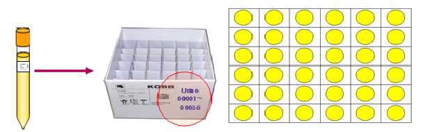 Urine 보관방법