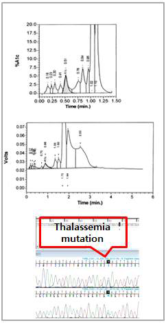 HbA1c variant window_thalassemia mutation