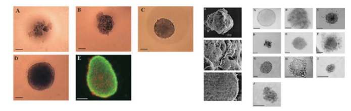 다양한 세포의 spheroid (HepG2, MCF-7, MCF-10a)