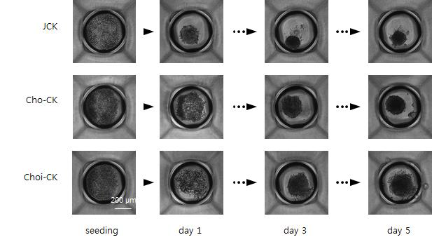 3차원 고용량 세포배양 소자에서 10% FBS가 포함된 DMEM을 이용한 환자 유래 담관암 세포 (JCK, Cho-CK, Choi-CK)의 배양.