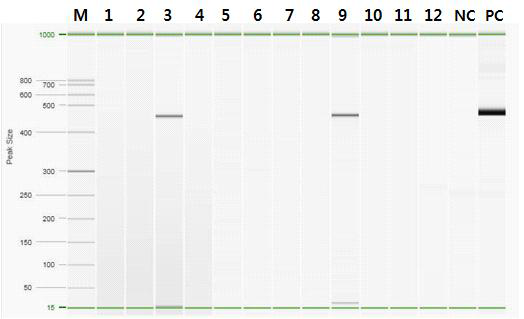 Gel electrophoresis pattern of Orientia tsutsugamushi by nested PCR from chigger collected on 1st week of Sep., 2014. Lane M, QX DNA size marker FX174/HaeⅢ. Lane 1~12, chigger samples. Lane 3, chigger samples of Apodemus agarurius collected at the position 3 in Chuncheon. Lane 9, chigger samples of Apodemus agarurius collected at the position 2 in Pyeongchang. Lane NC, Negative control. Lane PC, O. tsutsugamushi Positive control