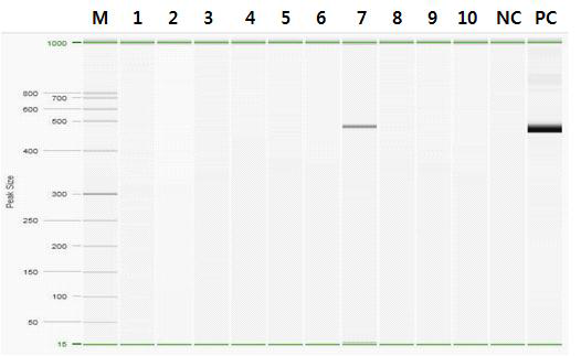 Gel electrophoresis pattern of Orientia tsutsugamushi by nested PCR from chigger collected on 3rd week of Sep., 2014. Lane M, QX DNA size marker FX174/HaeⅢ. Lane 1~10, chggers samples. Lane 7, chigger collected from Apodemus agarurius collected at the position 2 in Pyeongchang. Lane NC, Negative control. Lane PC, O. tsutsugamushi Positive control