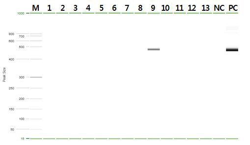 Gel electrophoresis pattern of Orientia tsutsugamushi by nested PCR from chigger collected on 1st week of Nov., 2014. Lane M, QX DNA size marker FX174/HaeⅢ. Lane 1~13, chggers samples. Lane 9, chigger collected from Apodemus agarurius collected at the position 3 in Chuncheon. Lane NC, Negative control, Lane PC, O. tsutsugamushi Positive control