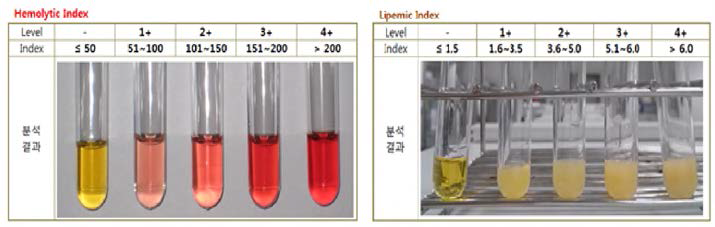 Serum Index Grade