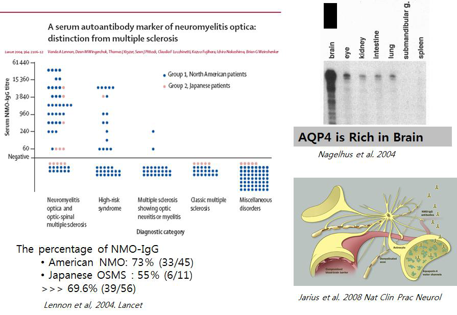 시신경척수염에 특이적인 자가항체 NMO-IgG(anti-aquaporin-4 antibody)