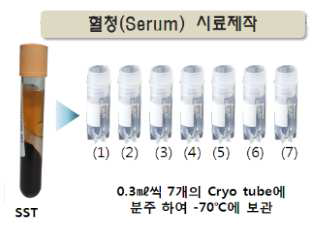혈청(Serum) 시료 제작