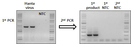 PCR amplification of Hanta virus