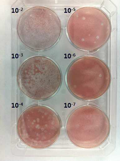 Plaque Assay results of Hanta virus