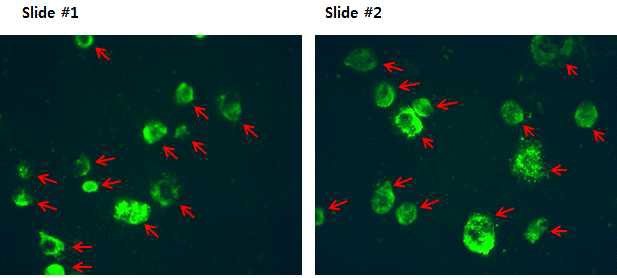 IFA results of Infection cell