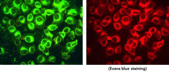 IFA results of infection cell