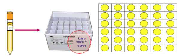 뇨(urine)자원 보관방법