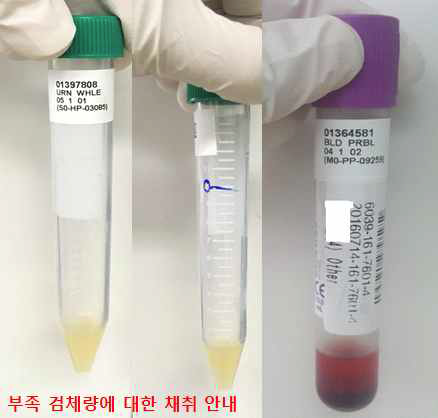 검체취급 부적합 교육 자료 예시