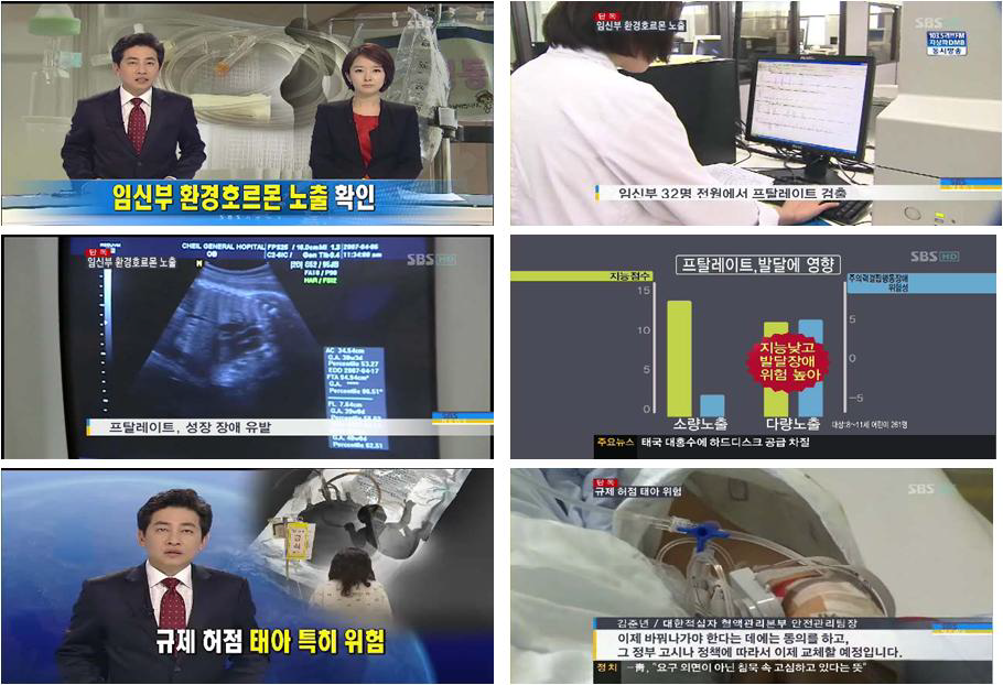 수액줄 환경호르몬 노출 관련 sbs 방송보도 장면