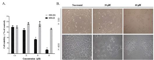 ofLBP6A 펩타이드의 인간 위암세포주와 인간 정상신장세포주에 대한 독 성효과(A) 및 인간 위암세포주의 세포 모양에 대한 영향