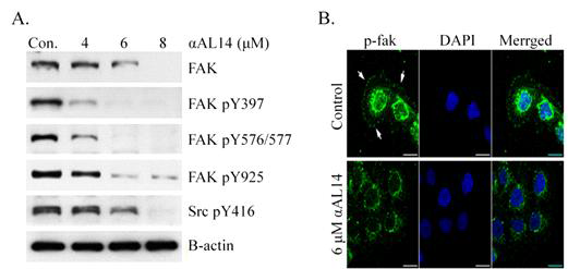 αAL14에 의한 FAK 단백질의 발현 및 활성 감소 효과