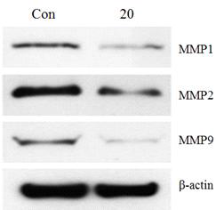 αAL14 펩타이드에 의한 CCD-986sk 세포내에서의 MMP1, MMP2, MMP9 발 현 변화