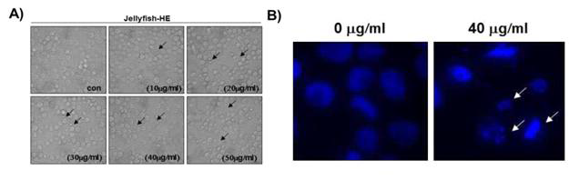 노무라입깃해파리 헥산추출물의 만성골수성백혈병 세포에 대한 세포사멸체 확 인(A), 그리고 세포사멸체 및 염색질 응축 사진(B),