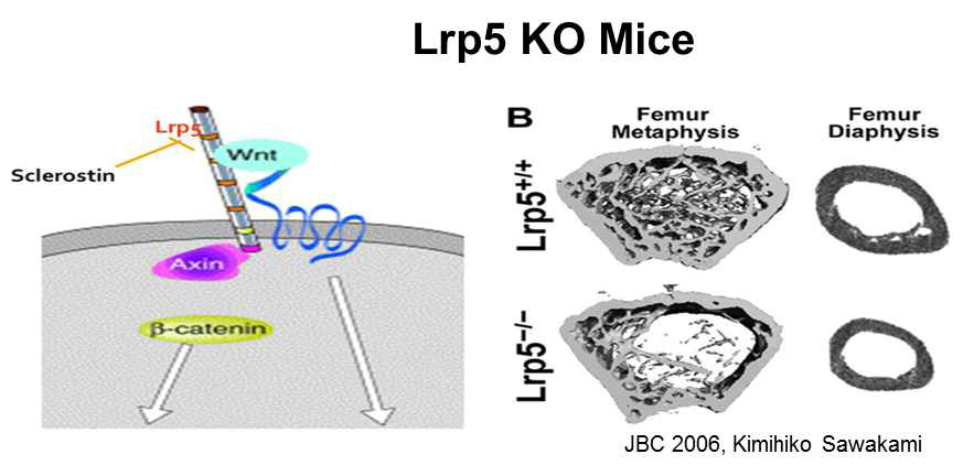 LRP5 와 골다공증과의 관련성