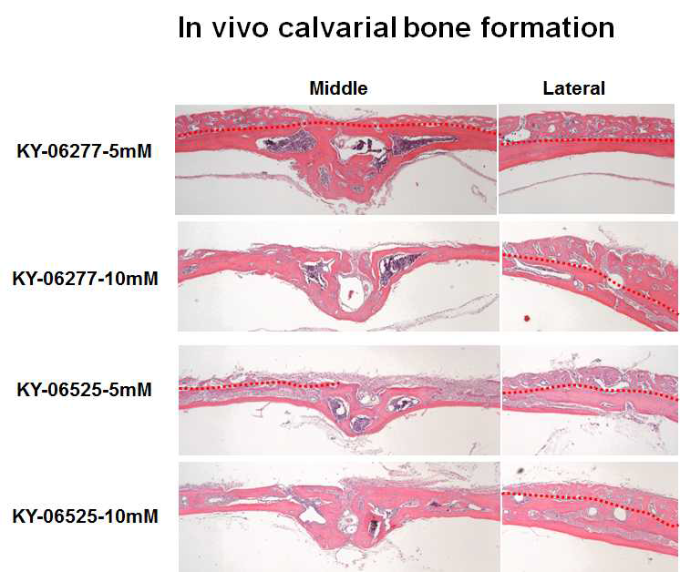 동물실험을 위한 후보 화합물의 Calvarial bone formation assay