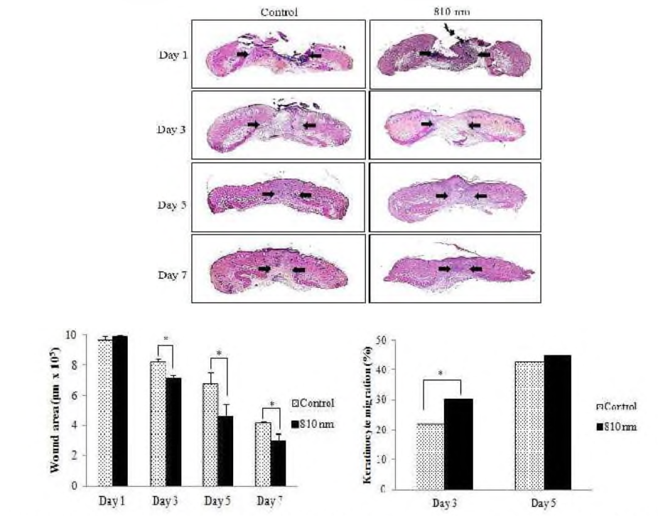 조직 염색 후 중앙부위의 상처부위의 조직 비교와 각질화세포 이동율 측정