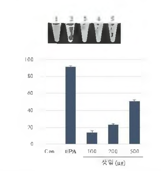 Fibrin clot assay of fresh leave of Dendropanax morbiferus