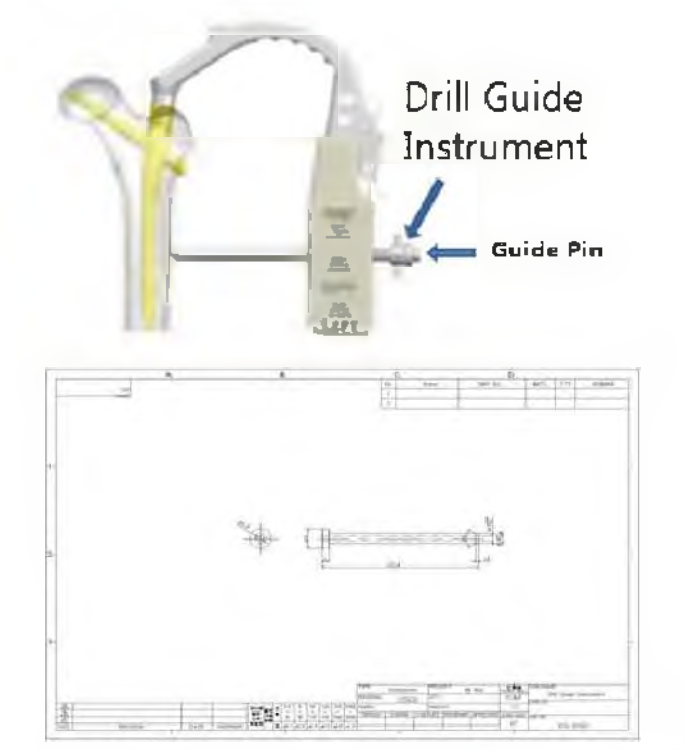 Drill Guide Instrument 적용 부위 및 설계 도면