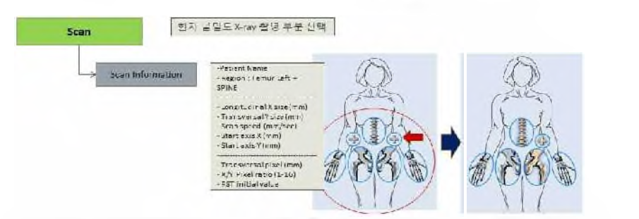 골 밀 도 측 정 기 환 자 촬영 시 영역 선택 및 스캔 방법 개 념 도