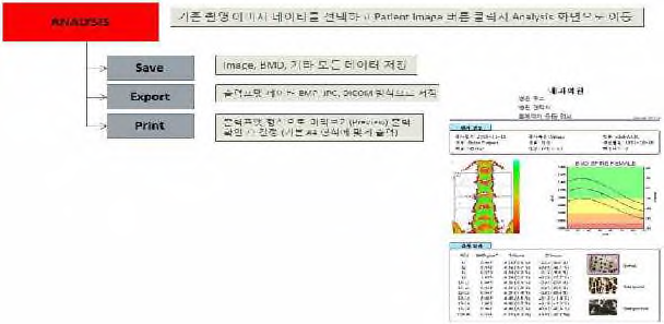 골밀도측정기 환자 골밀도 분석 소프트웨어 개념도