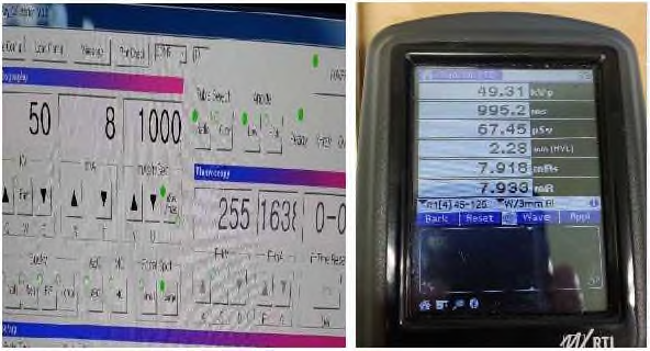 X-ray 계측 테스트 결과1