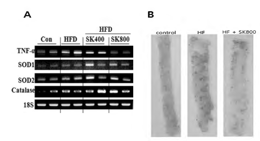 Effect of SK2 on aorta in mice.