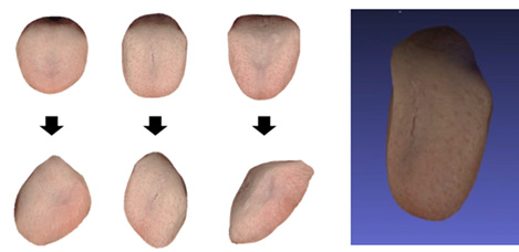 혀의 3차원 측정 적용 사례