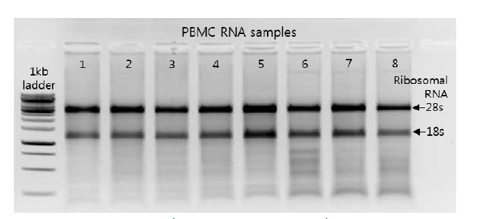 PBMC RNA quality