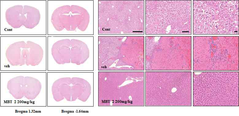 미병 후보 약물 MBT2의 뇌/ 간조직의 조직병리학적 변화