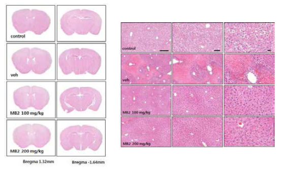 미병 후보 약물 MB2의 뇌/ 간조직의 조직병리학적 변화