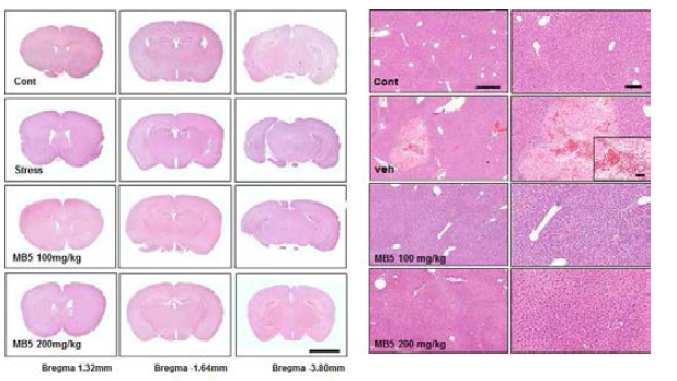 미병 후보 약물 MB5의 뇌/ 간조직의 조직병리학적 변화