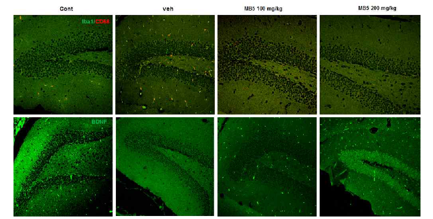 미병 후보 약물 MB5의 뇌/ 간조직의 조직병리학적 변화