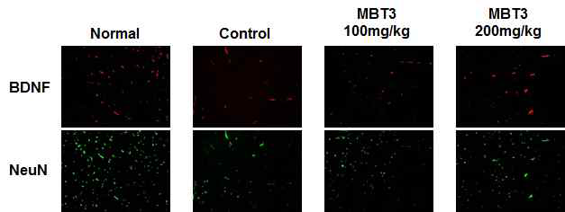 미병 후보 약물 MBT3의 뇌신경생성인자 발현 증가