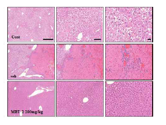 미병 후보 약물 MBT2의 간손상 보호 효과