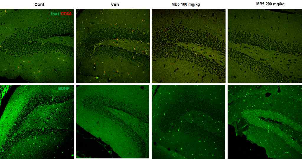 미병 후보 약물 MB5의 뇌/ 간조직의 조직병리학적 변화