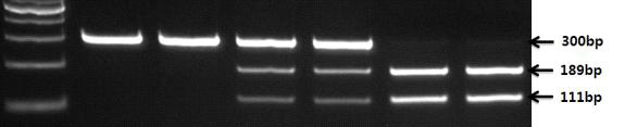 제한효소 절단 양상에 의한 유전자형 판독