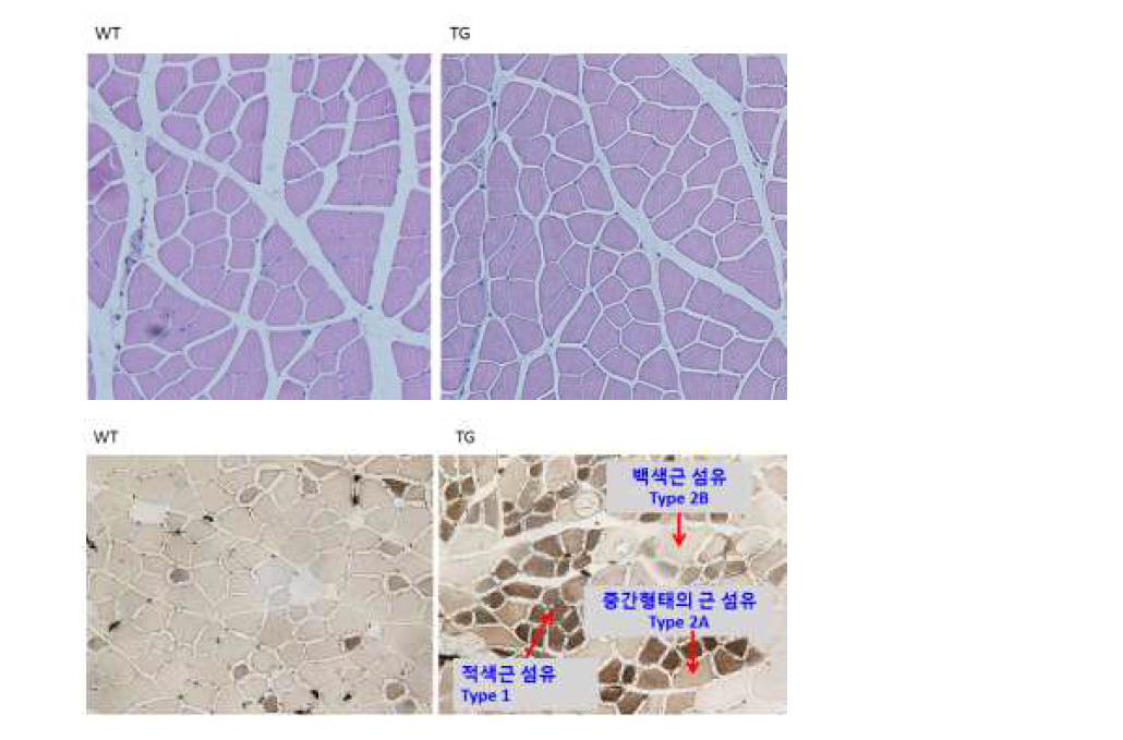 (상) Hematoxylin and eosin stain; (하) ATPase staining